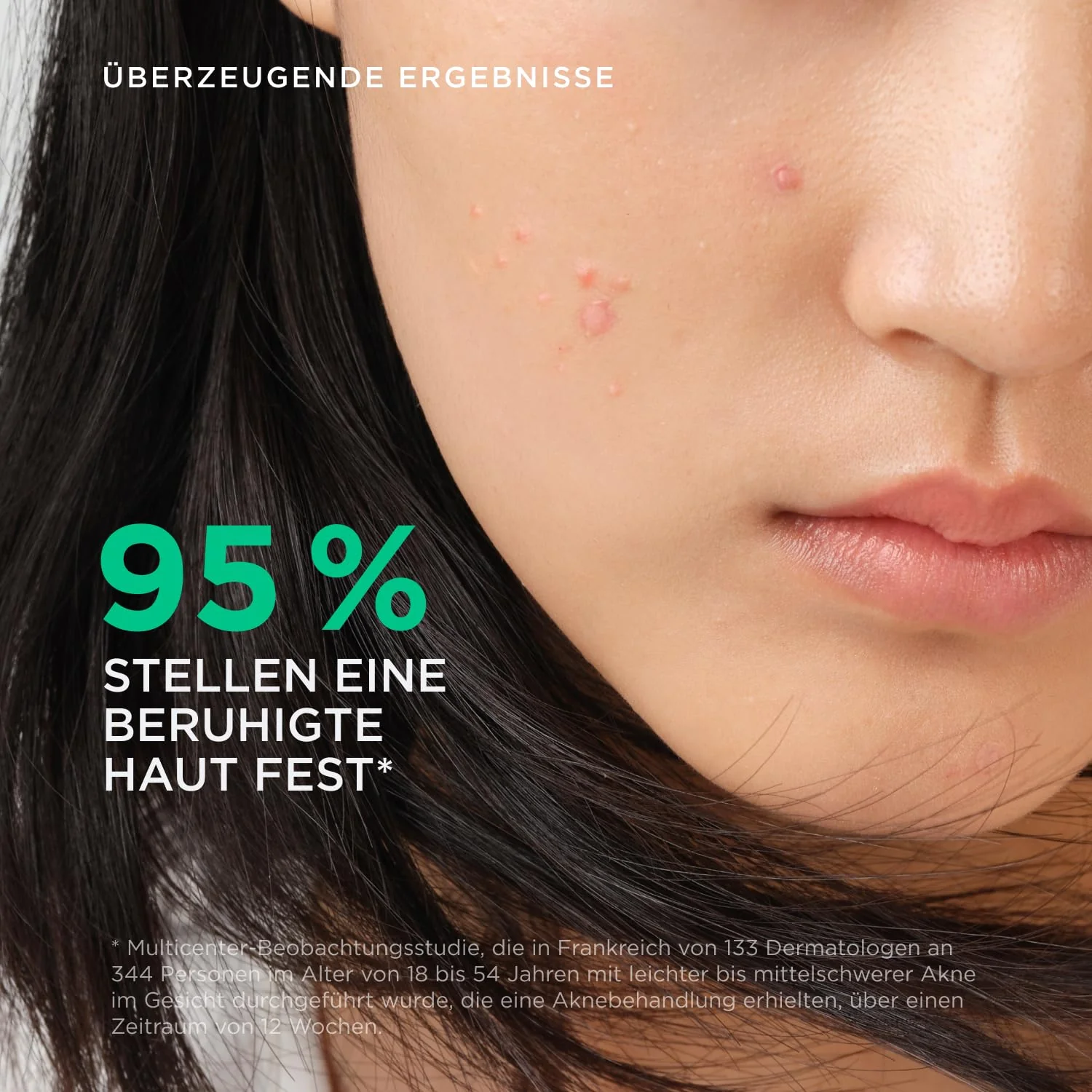 Bioderma Sébium Hydra Ultra-Moisturising Feuchtigkeitscreme - Image 3
