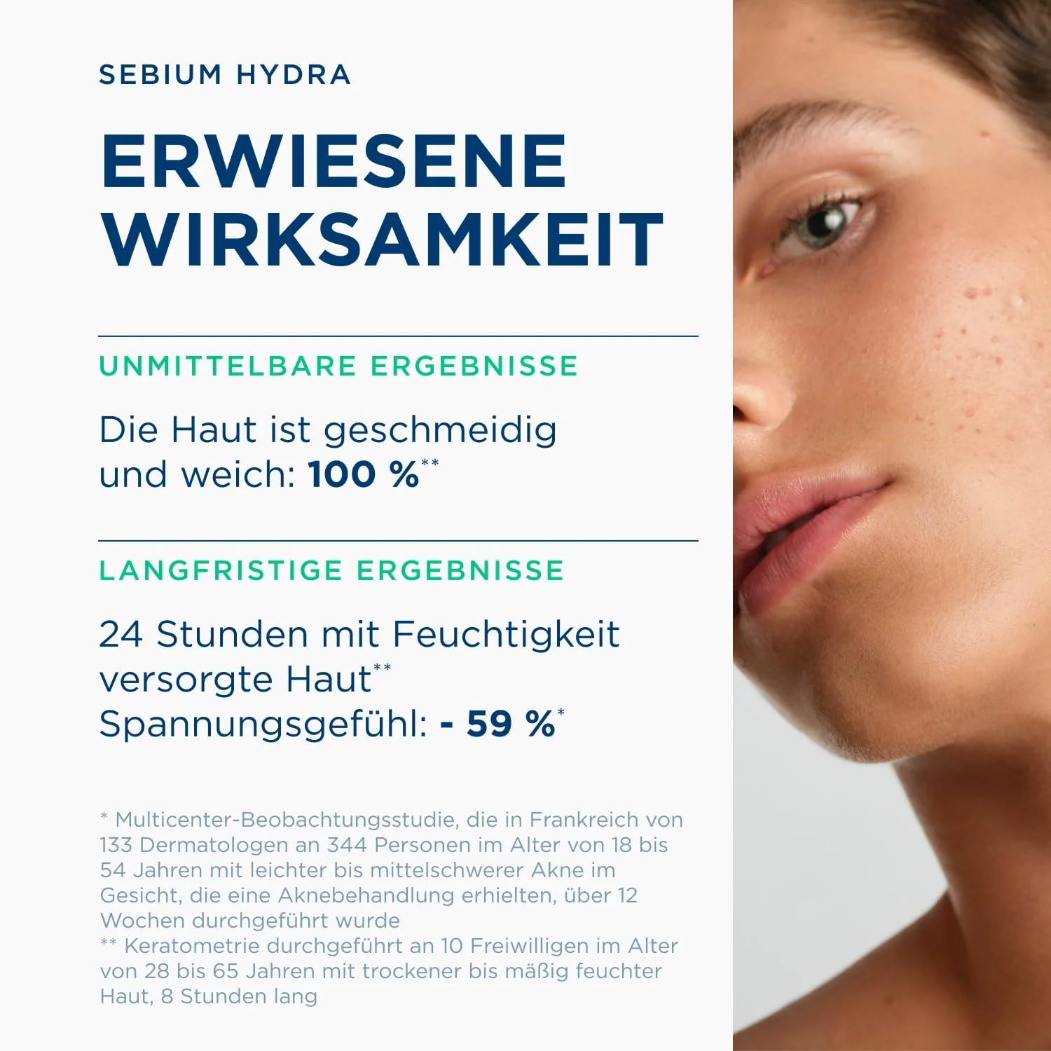 Bioderma Sébium Hydra Ultra-Moisturising Feuchtigkeitscreme - Image 4