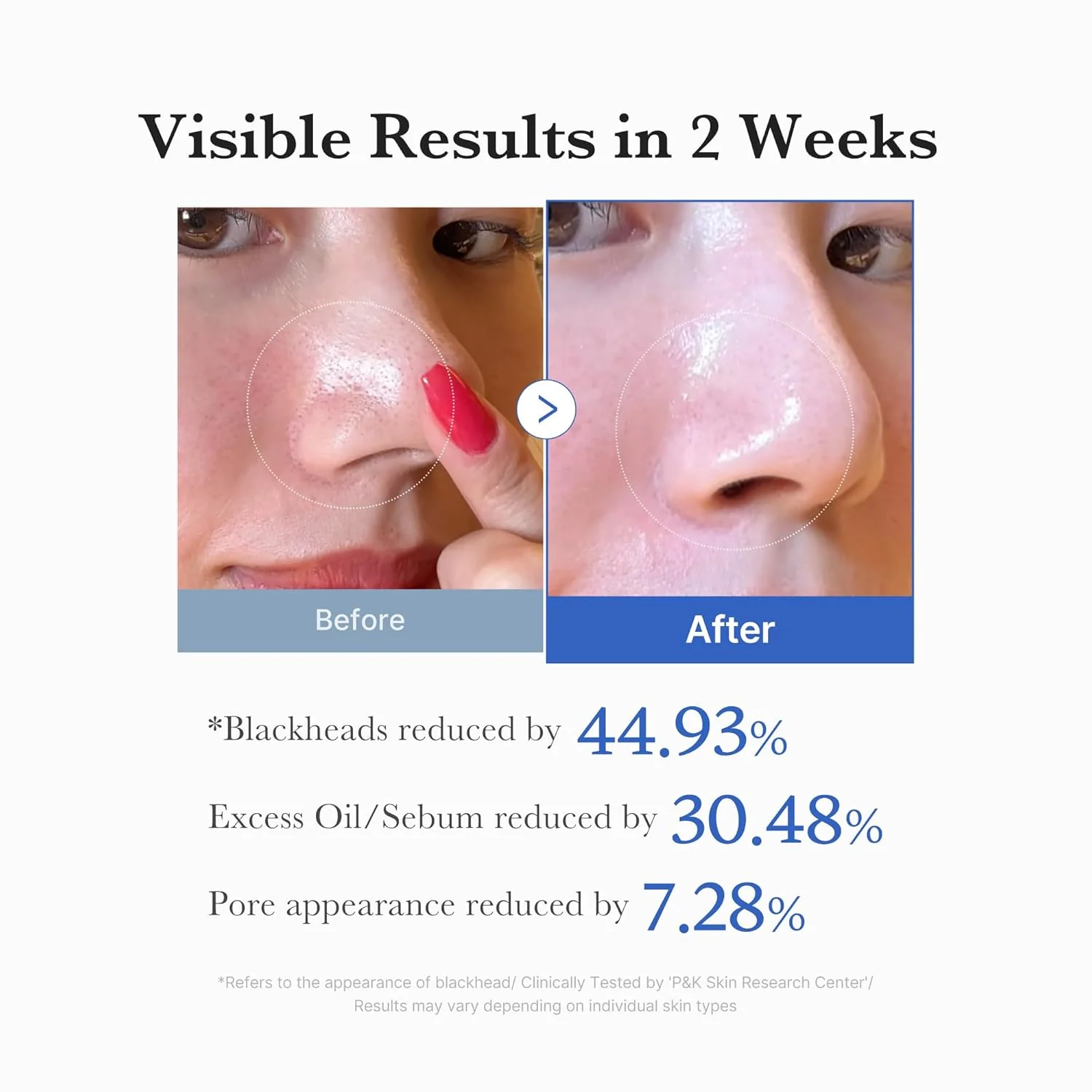 medicube Zero Pore Pad 2.0 - Image 3