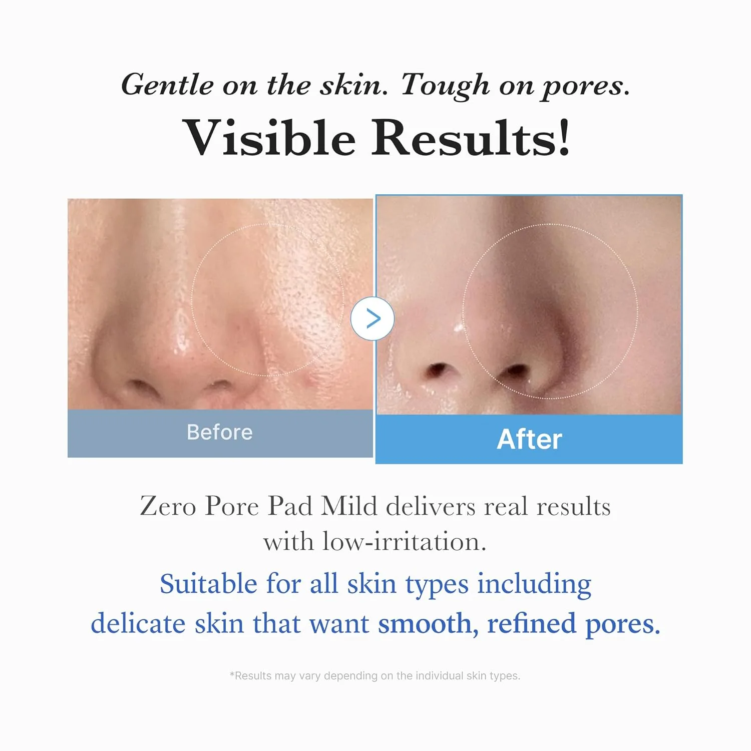medicube Zero Pore Pad Mild - Image 3